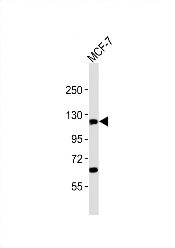 ZNF217 Antibody