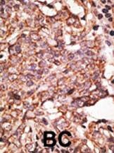 SIGLEC6 Antibody