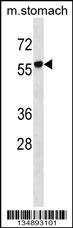 RUNDC1 Antibody