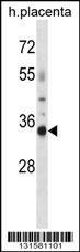 OR4K13 Antibody