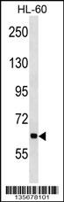 ANKHD1 Antibody