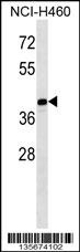 MAGEB10 Antibody