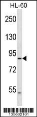 DNAH2 Antibody