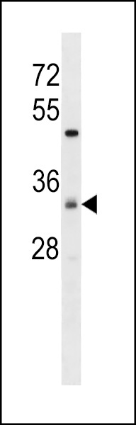 ZDHHC7 Antibody