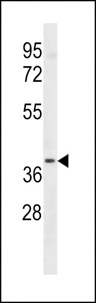 LTB4R2 Antibody