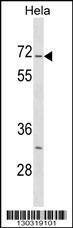 Stk3 Antibody