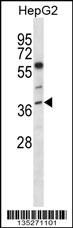 NEIL2 Antibody