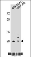 FOLR2 Antibody
