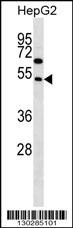 FAM83A Antibody