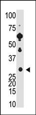 Recoverin Antibody