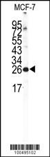 NCS1 Antibody