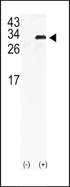 GJB6 Antibody