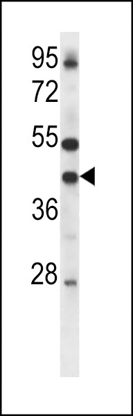 GJA4 Antibody