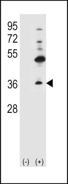 Connexin 30.3 Antibody