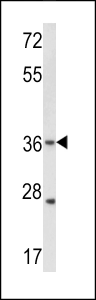 Connexin 31 Antibody
