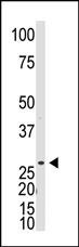 DKKL1 Antibody