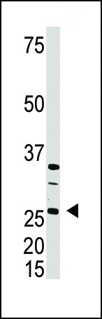 DKK4 Antibody