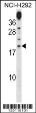 PRR15 Antibody