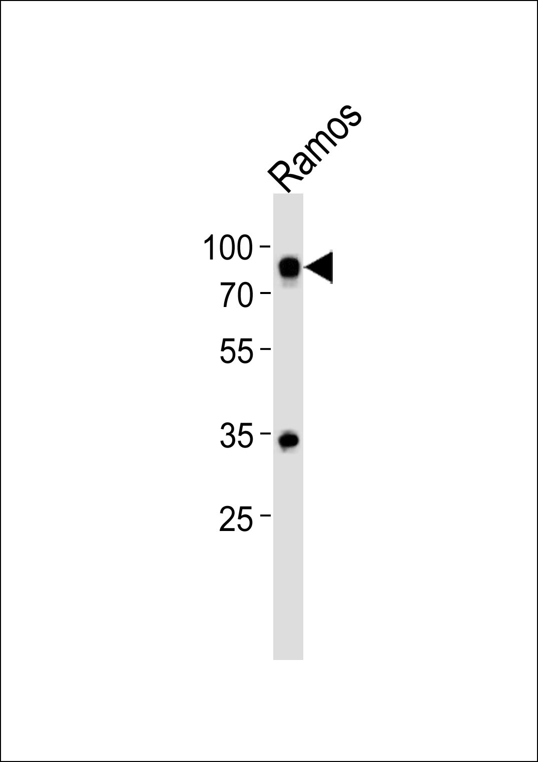 CD19 Antibody