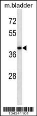 USP12 Antibody