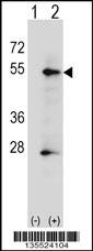 ALPP Antibody
