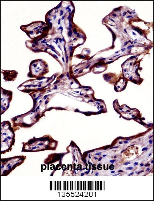 ALPP Antibody