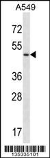 UTS2R Antibody