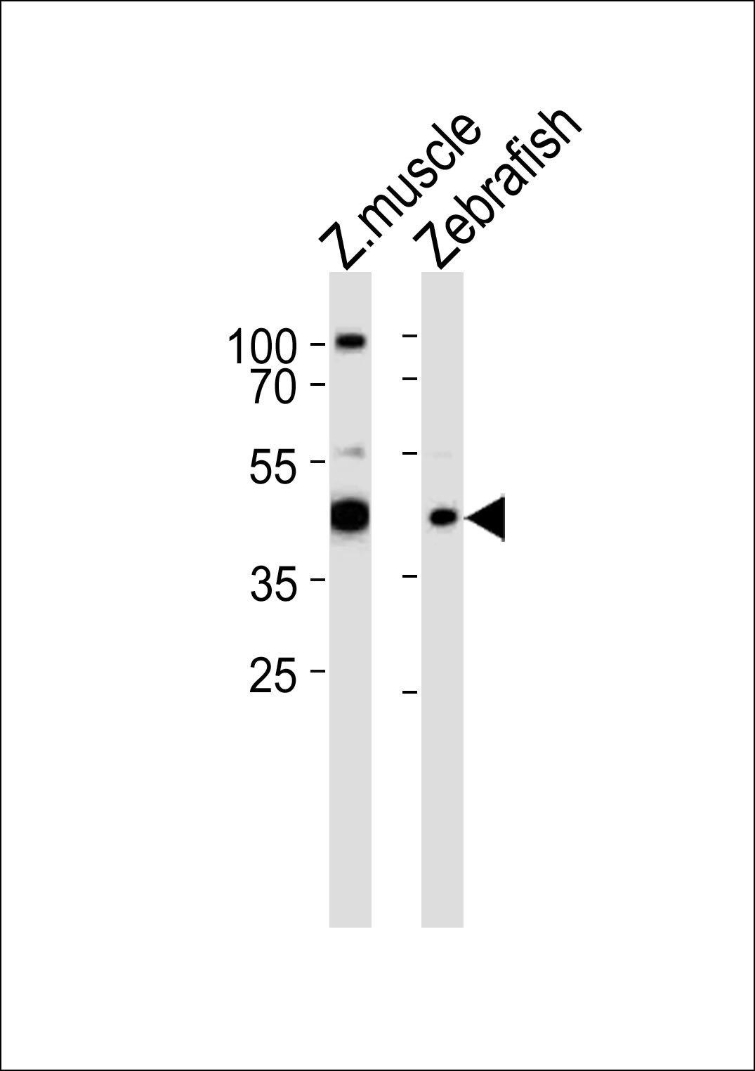 RBM22 Antibody