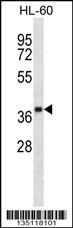 OR5F1 Antibody