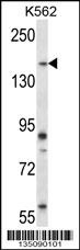 Peak1 Antibody