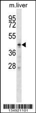 ZDHHC6 Antibody