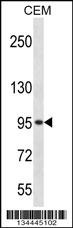 Adrbk2 Antibody