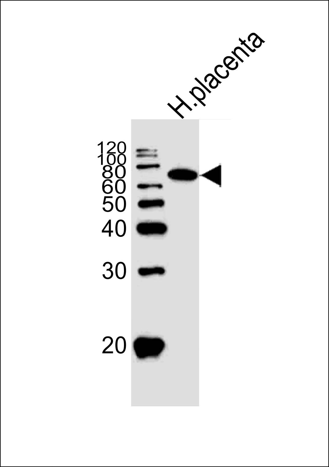 Alkaline Phosphatase Antibody