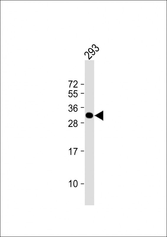 TGIF2 Antibody