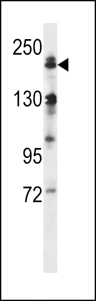 MAP3K4 Antibody