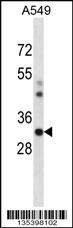Csnk1a1 Antibody