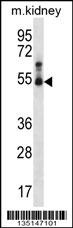 Mouse Stk32b Antibody