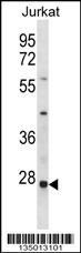 HTATIP2 Antibody