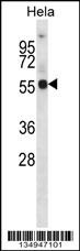 KCNA1 Antibody
