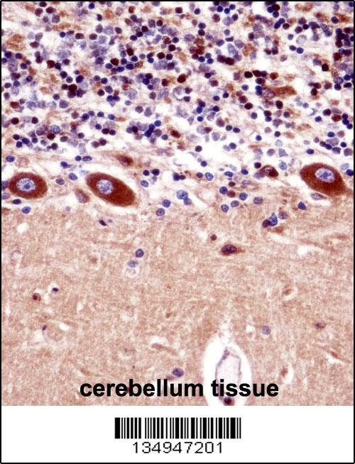 KCNA1 Antibody