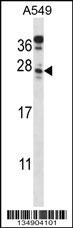 C4orf49 Antibody