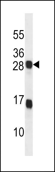 KDELR2 Antibody