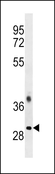 TRA2B Antibody