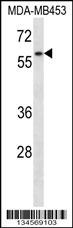 FANCG Antibody