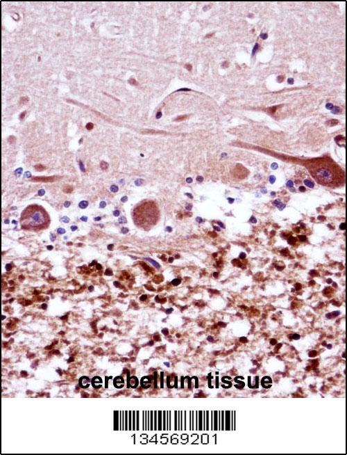 FANCG Antibody