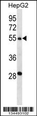 TMPRSS13 Antibody