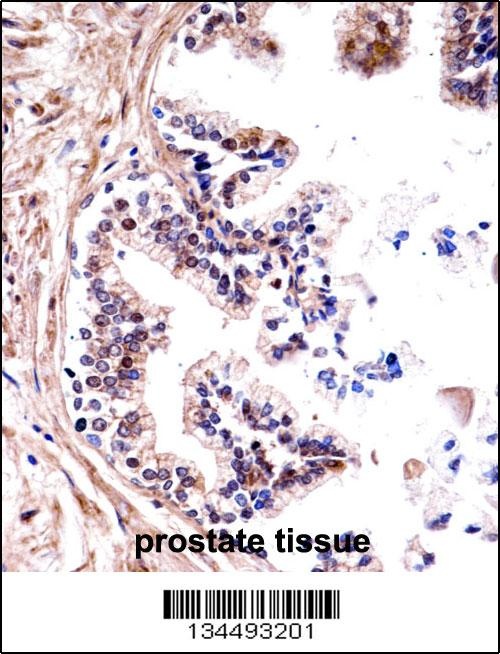 TMPRSS13 Antibody