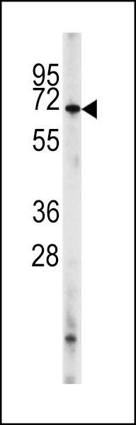 PDE8A Antibody