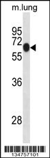 Mouse Dyrk1b Antibody
