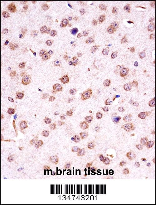 Chuk Antibody